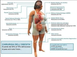 Scopri di più sull'articolo Due parole sull’obesità