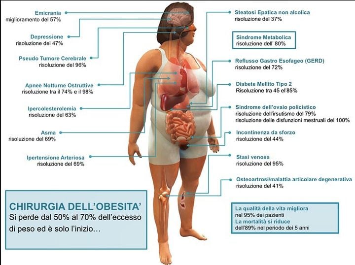 Al momento stai visualizzando Due parole sull’obesità